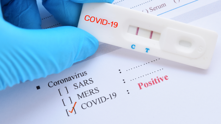 Det är viktigt att ett test har hög specificitet, det vill säga att det enbart ger positivt utslag på de som har eller har haft covid-19 och inte vid andra virus. Foto Shutterstock